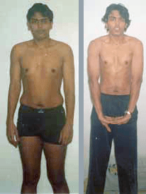 Abhinav's Fat Vanish natural weight loss photo